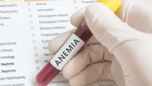 Anemia: green tea side effects